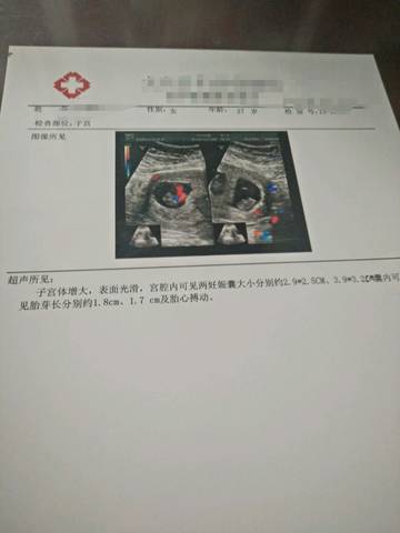 journal_insert_pic_871619125