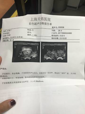 journal_insert_pic_872559917