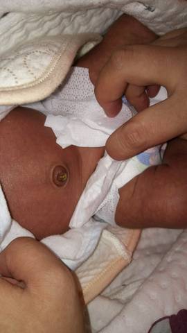 2岁宝宝正常肚脐照片图片