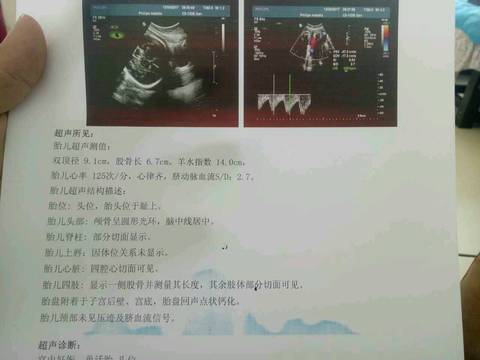 journal_insert_pic_876880321