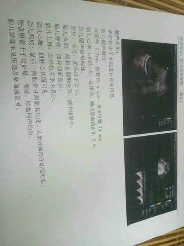 journal_insert_pic_876880310