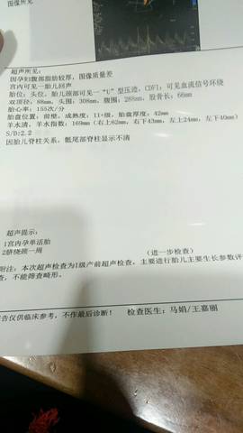 journal_insert_pic_876735749