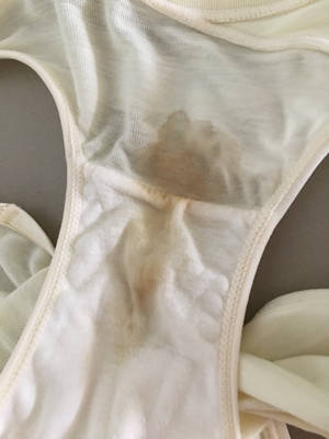 请问这是破水的情况吗