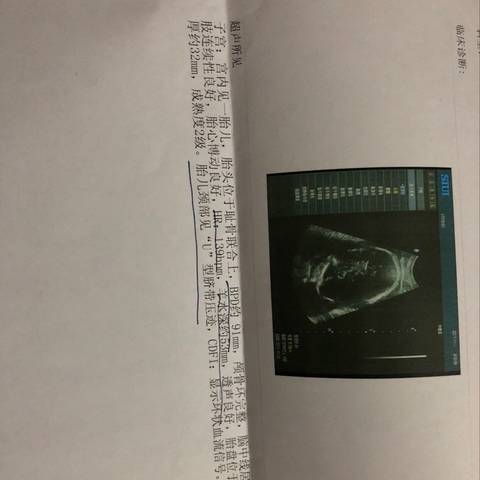 journal_insert_pic_882728687