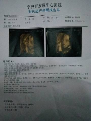 journal_insert_pic_885459477