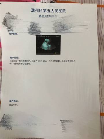 journal_insert_pic_885912596