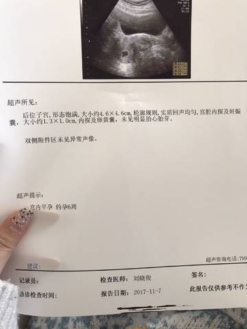 journal_insert_pic_885967088