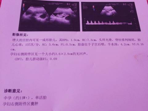 journal_insert_pic_886074006