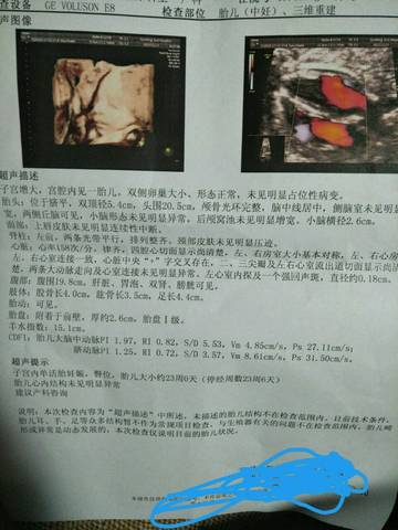 journal_insert_pic_886346251