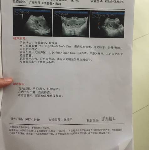 journal_insert_pic_887080165