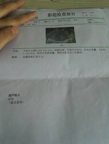 journal_insert_pic_886737989