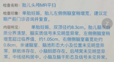 journal_insert_pic_888151132