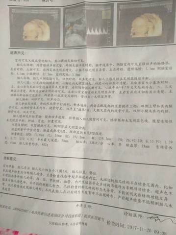 journal_insert_pic_888259262