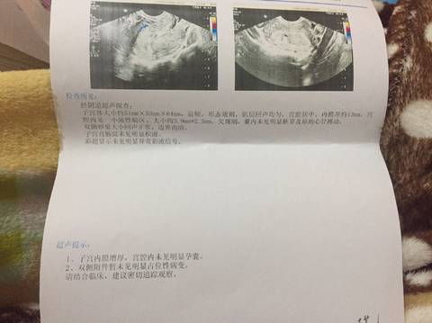 journal_insert_pic_888546459