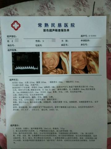journal_insert_pic_889731752