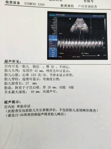 journal_insert_pic_890159005