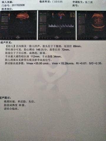 journal_insert_pic_892059429
