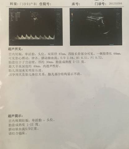 journal_insert_pic_895093442
