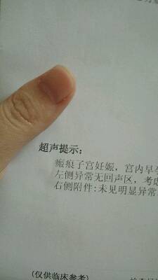 journal_insert_pic_898547008