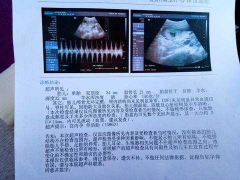 journal_insert_pic_907137444