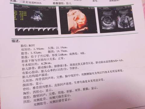 journal_insert_pic_909286595