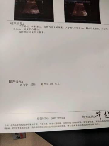 journal_insert_pic_910764313