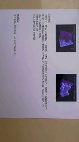 journal_insert_pic_912828721
