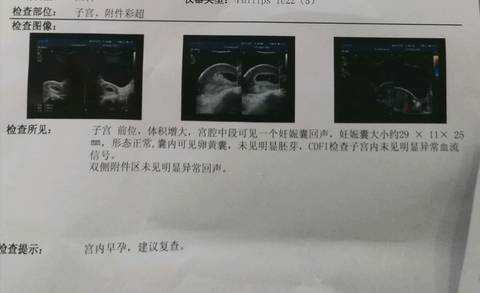journal_insert_pic_913141541