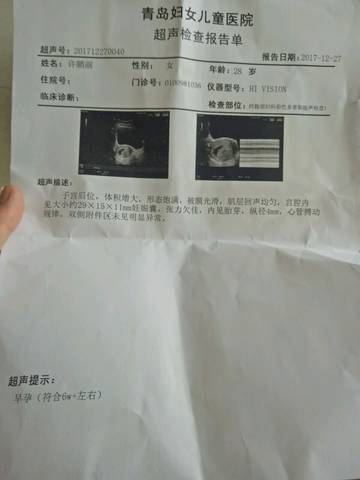 journal_insert_pic_913031461