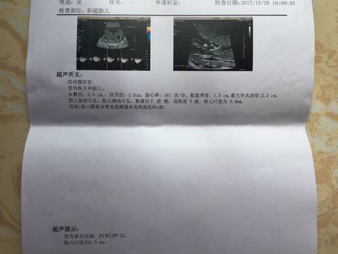 journal_insert_pic_913733318