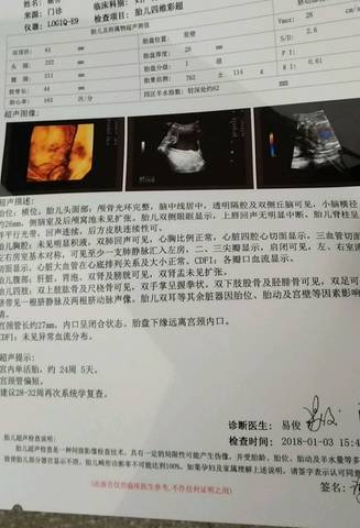 journal_insert_pic_919071716