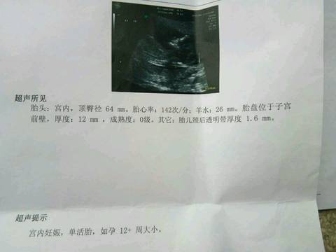 journal_insert_pic_919983012