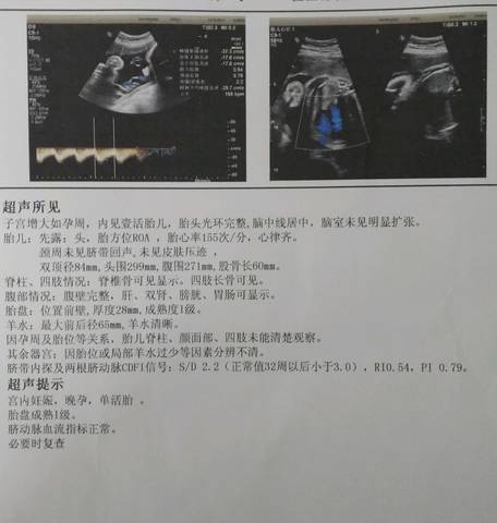 journal_insert_pic_920181869