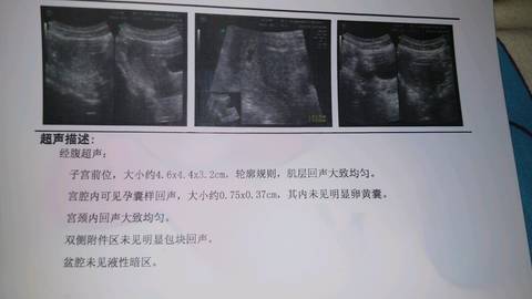 journal_insert_pic_921490294