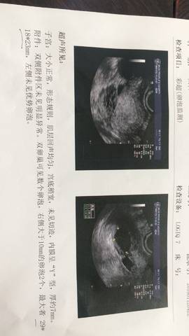 journal_insert_pic_924165457