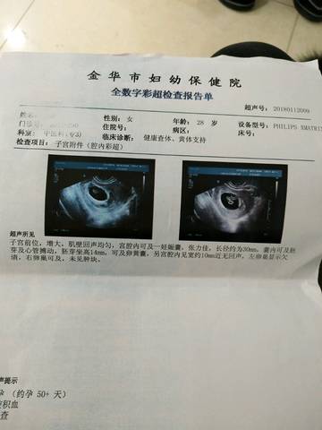 journal_insert_pic_924712444