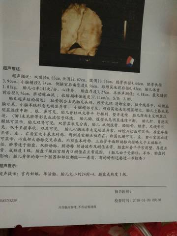 journal_insert_pic_925381715
