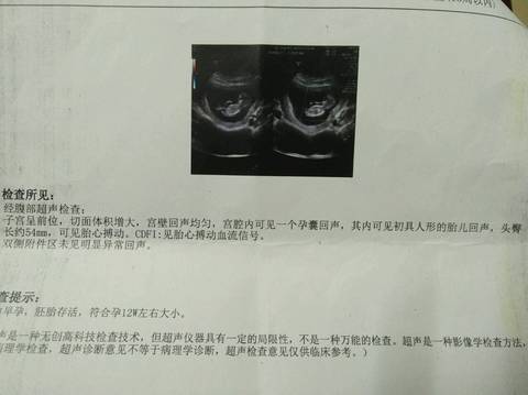 journal_insert_pic_925432621