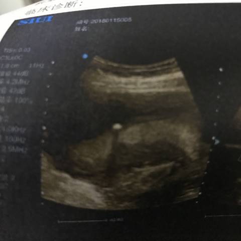 journal_insert_pic_926173861