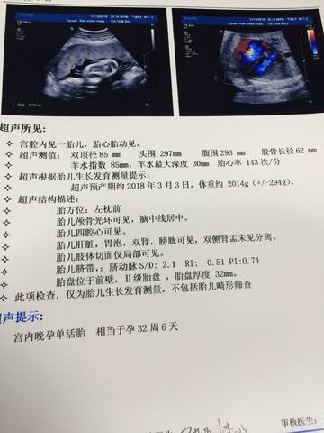 journal_insert_pic_925715926