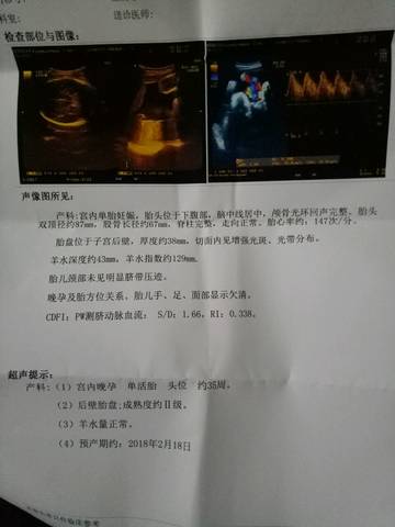 journal_insert_pic_927458516