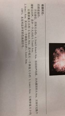 journal_insert_pic_929335571