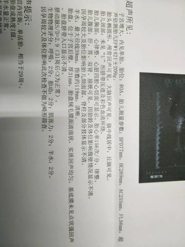 journal_insert_pic_929512196