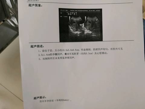 journal_insert_pic_929051044