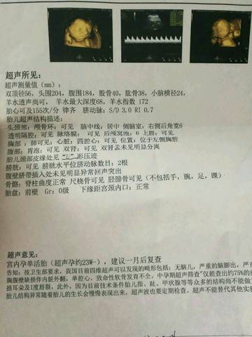 journal_insert_pic_932566379