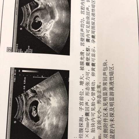 journal_insert_pic_933760459