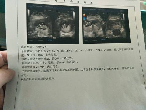 journal_insert_pic_934555856