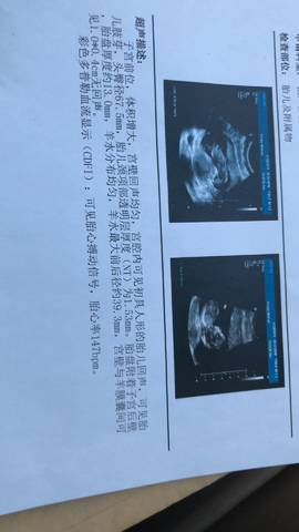 journal_insert_pic_935352522