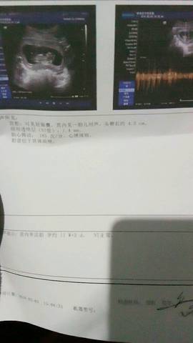 journal_insert_pic_938073812