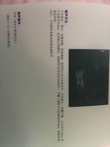 journal_insert_pic_938514352